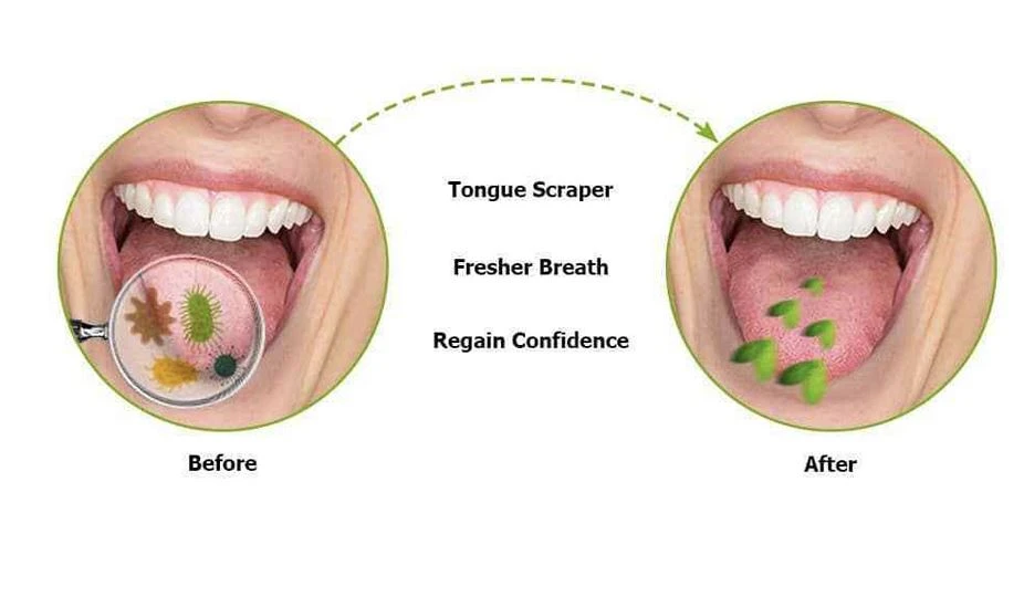 tongue cleaner 